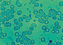 Metoda RUŠ - názor lékaře (dekompenzovaný diabetes II. typu - cukrovka)